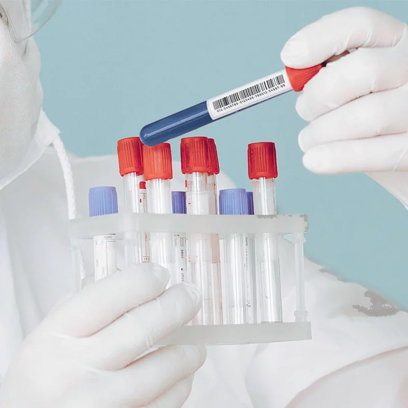 Étiquettes congélation - Image 3